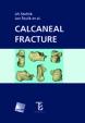 Calcaneal Fracture