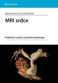 MRI srdce -  praktické využití z pohledu kardiologa