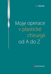 Moje operace v plastické chirurgii od A do Z