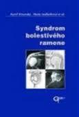 Syndrom bolestivého ramene