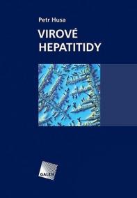 Virové hepatitidy