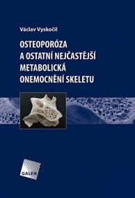 Osteoporóza a ostatní nejčastější metabolická onemocnění skeletu