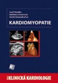 Kardiomyopatie