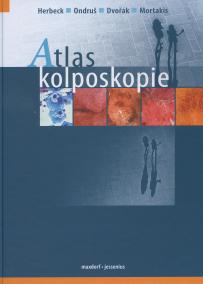 Atlas kolposkopie