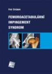 Femoroacetabulární impingement syndrom